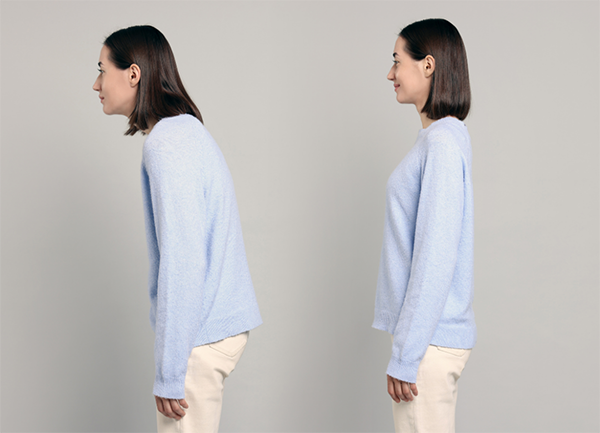 Good posture and poor posture